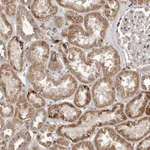 Atlas Antibodies Anti-AKAP7 Antibody