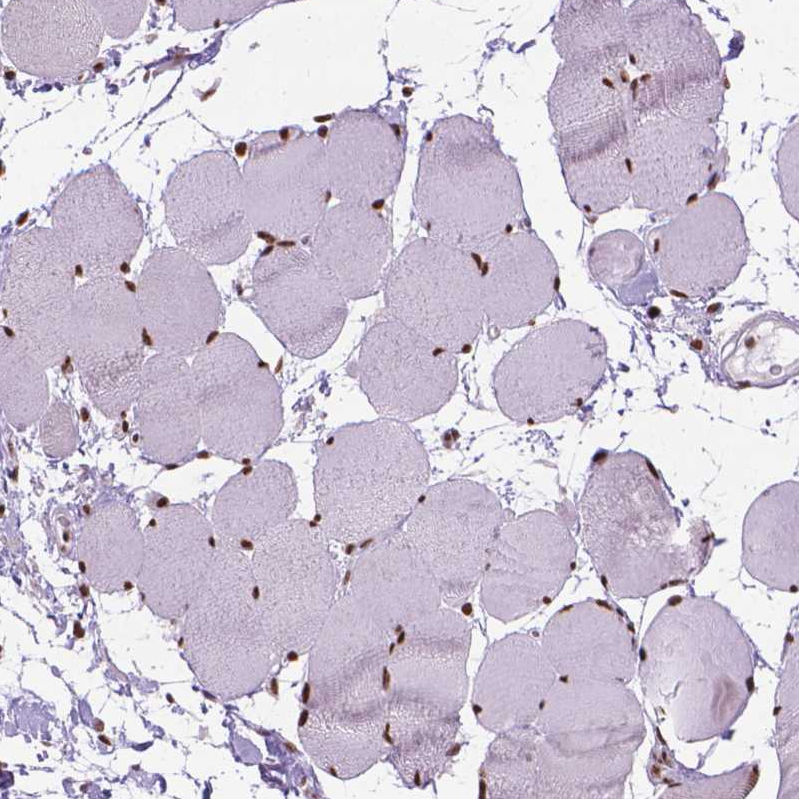 Atlas Antibodies Anti-AKAP8 Antibody