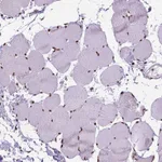 Atlas Antibodies Anti-AKAP8 Antibody