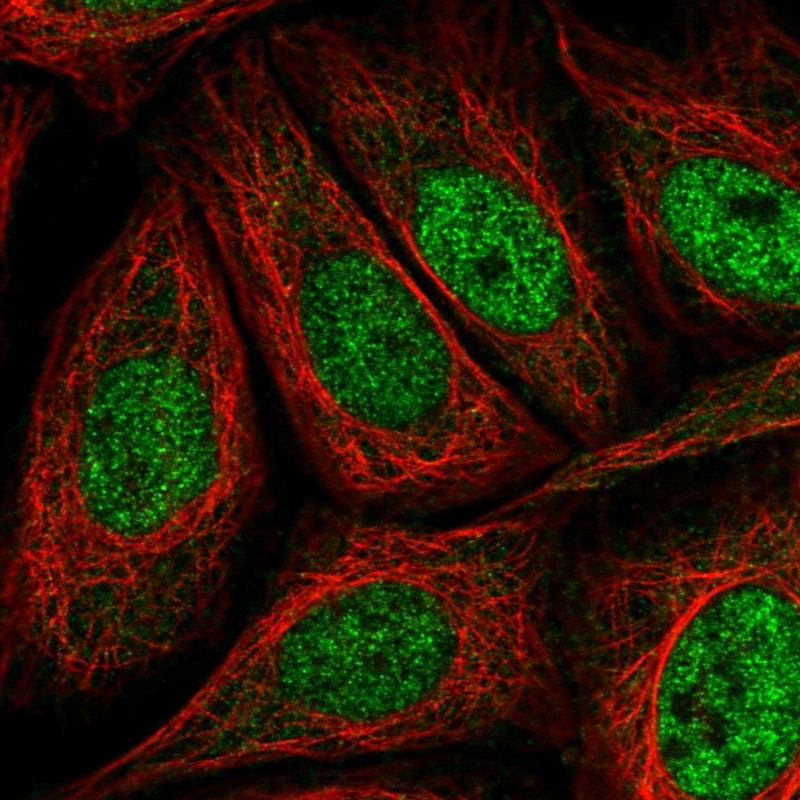 Atlas Antibodies Anti-AKIP1 Antibody
