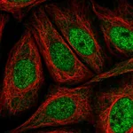Atlas Antibodies Anti-AKIP1 Antibody