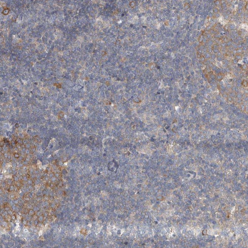 Atlas Antibodies Anti-AKNAD1 Antibody