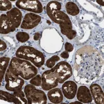 Atlas Antibodies Anti-AKR1A1 Antibody
