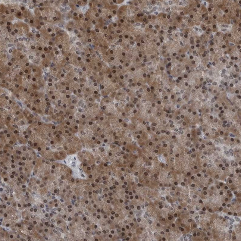 Atlas Antibodies Anti-AKR1A1 Antibody