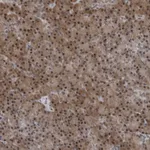 Atlas Antibodies Anti-AKR1A1 Antibody