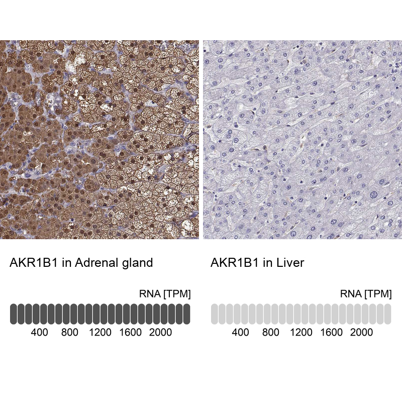 Atlas Antibodies Anti-AKR1B1 Antibody