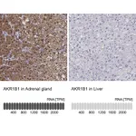 Atlas Antibodies Anti-AKR1B1 Antibody