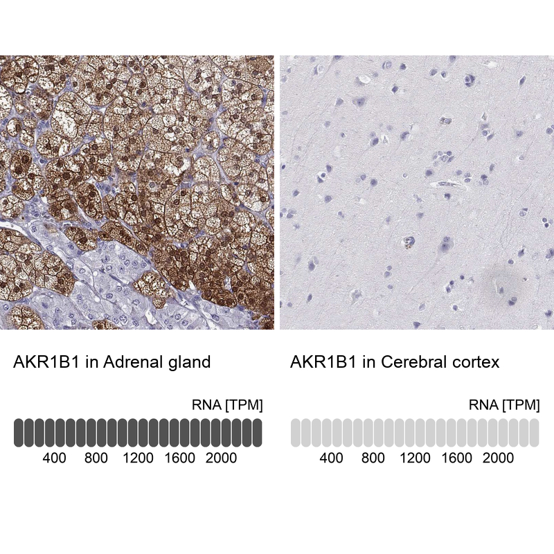 Atlas Antibodies Anti-AKR1B1 Antibody