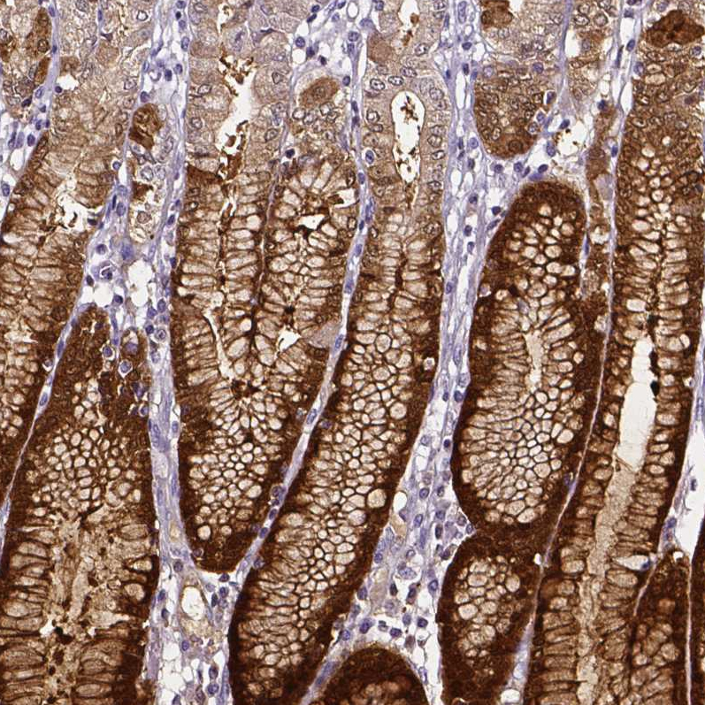 Atlas Antibodies Anti-AKR1B10 Antibody