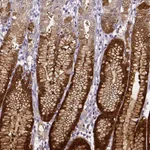 Atlas Antibodies Anti-AKR1B10 Antibody