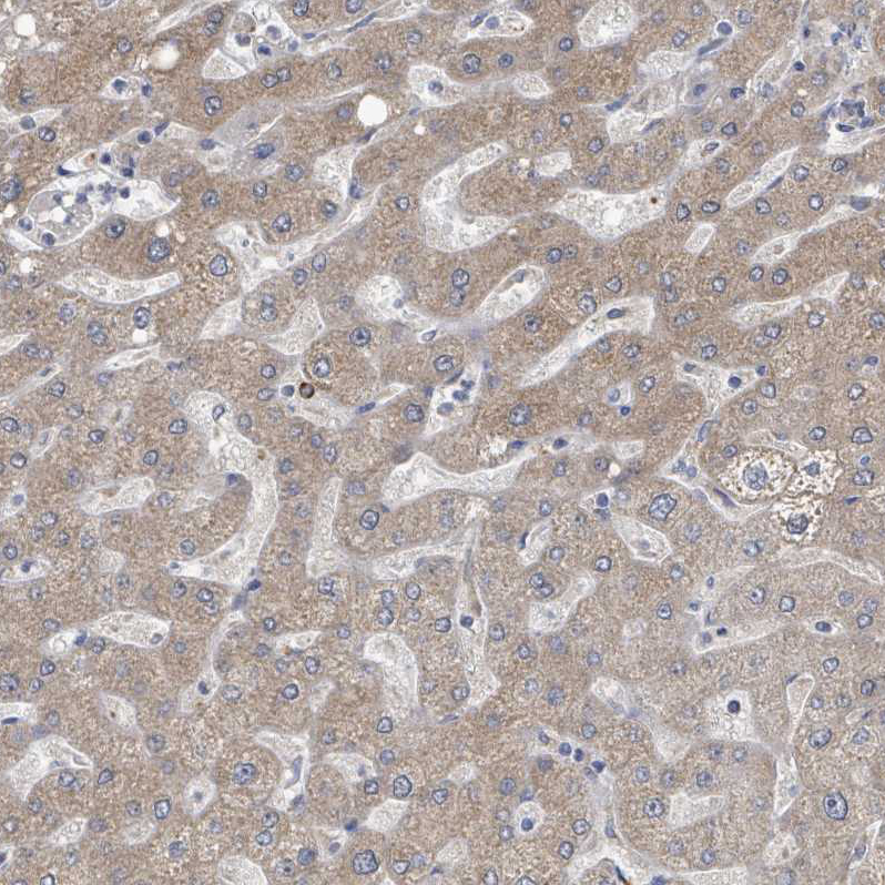 Atlas Antibodies Anti-AKR1C4 Antibody