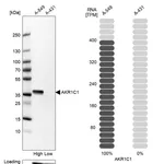 Atlas Antibodies Anti-AKR1C1 Antibody