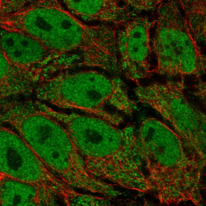 Atlas Antibodies Anti-AKR1E2 Antibody
