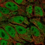 Atlas Antibodies Anti-AKR1E2 Antibody