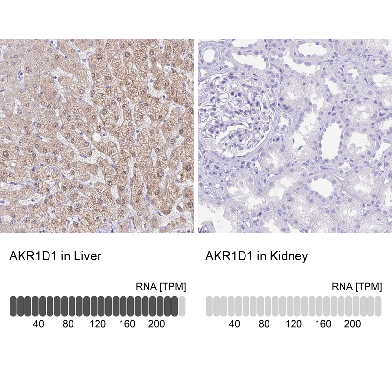 Atlas Antibodies Anti-AKR1D1 Antibody