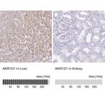 Atlas Antibodies Anti-AKR1D1 Antibody