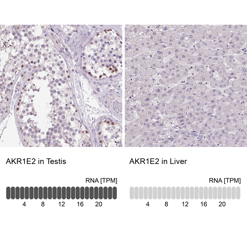 Atlas Antibodies Anti-AKR1E2 Antibody