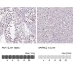 Atlas Antibodies Anti-AKR1E2 Antibody