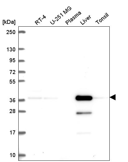 Atlas Antibodies Anti-AKR7A2 Antibody