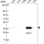 Atlas Antibodies Anti-AKR7A2 Antibody
