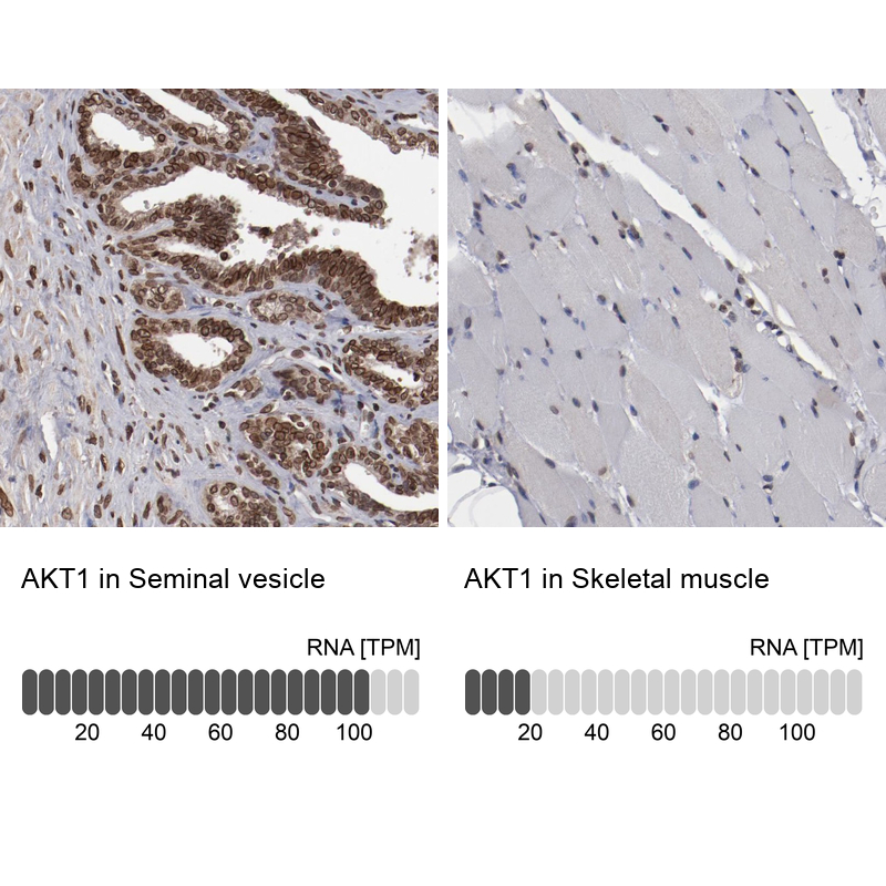 Atlas Antibodies Anti-AKT1 Antibody