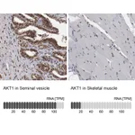 Atlas Antibodies Anti-AKT1 Antibody