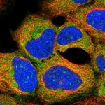 Atlas Antibodies Anti-AKT1S1 Antibody