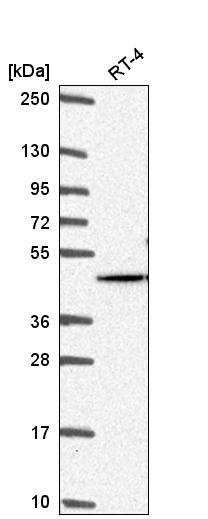 Atlas Antibodies Anti-AKT2 Antibody