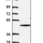 Atlas Antibodies Anti-AKT2 Antibody