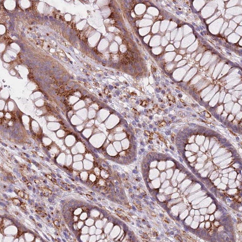 Atlas Antibodies Anti-AKTIP Antibody