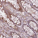 Atlas Antibodies Anti-AKTIP Antibody