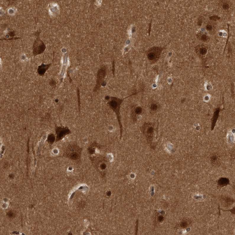 Atlas Antibodies Anti-AKT3 Antibody