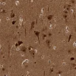 Atlas Antibodies Anti-AKT3 Antibody