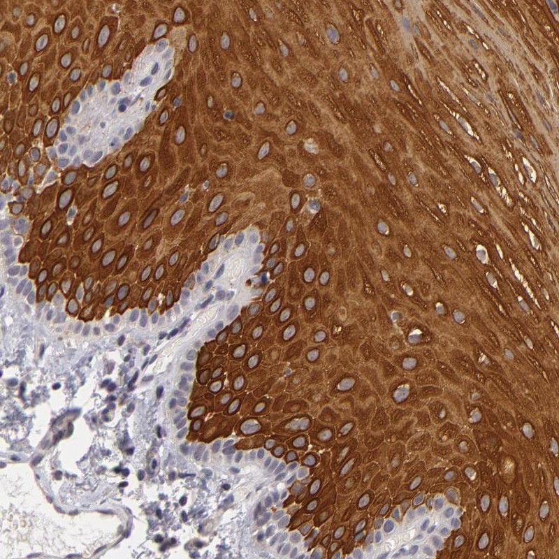 Atlas Antibodies Anti-ALAS2 Antibody