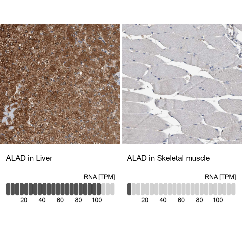 Atlas Antibodies Anti-ALAD Antibody