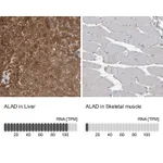 Atlas Antibodies Anti-ALAD Antibody