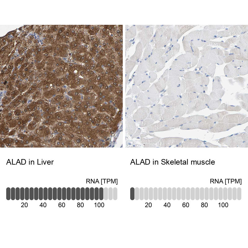 Atlas Antibodies Anti-ALAD Antibody