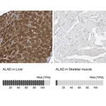 Atlas Antibodies Anti-ALAD Antibody