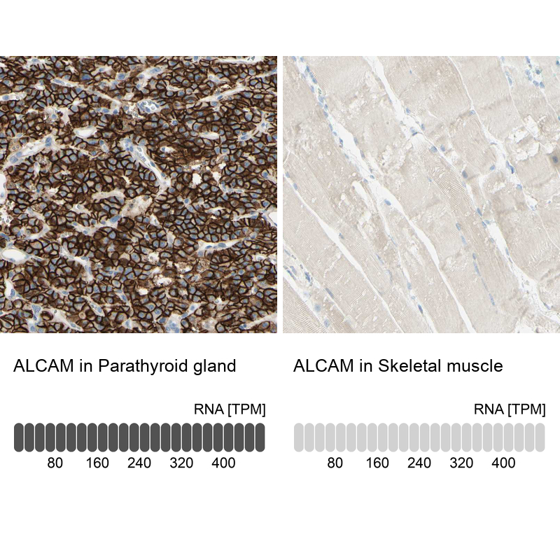 Atlas Antibodies Anti-ALCAM Antibody