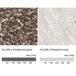 Atlas Antibodies Anti-ALCAM Antibody