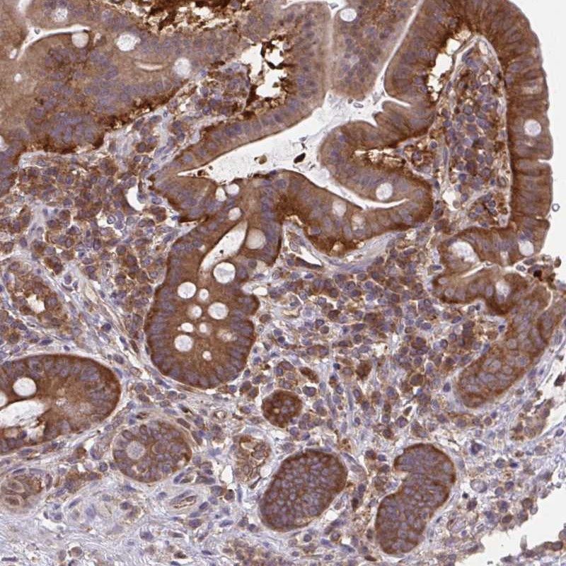 Atlas Antibodies Anti-ALDH16A1 Antibody