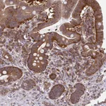 Atlas Antibodies Anti-ALDH16A1 Antibody