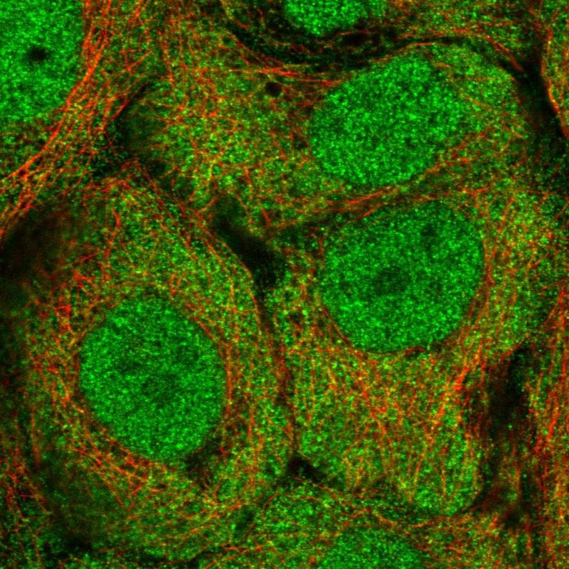 Atlas Antibodies Anti-ALDH1A3 Antibody