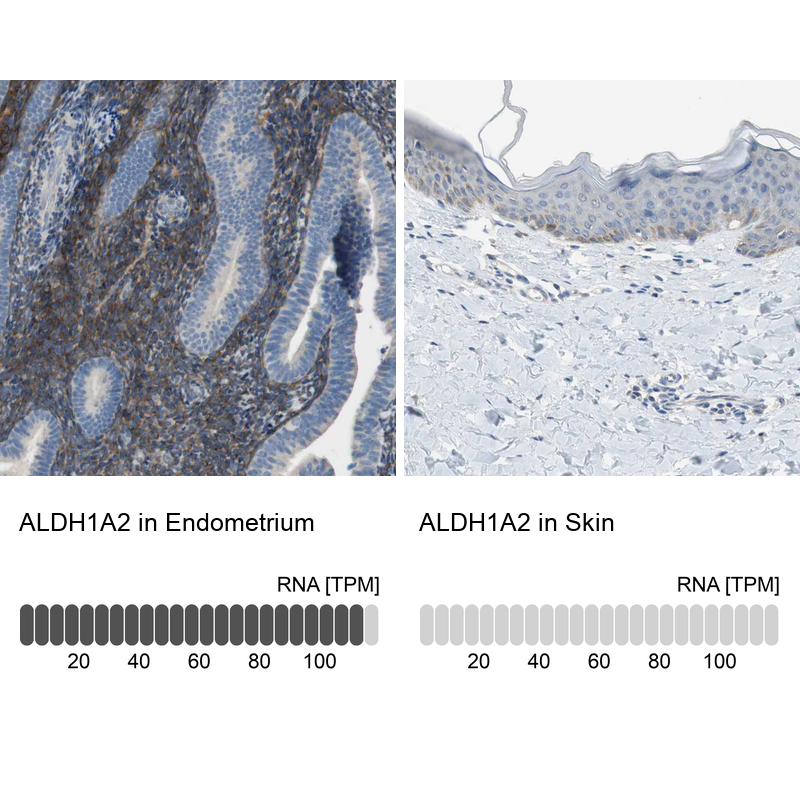 Atlas Antibodies Anti-ALDH1A2 Antibody