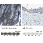 Atlas Antibodies Anti-ALDH1A2 Antibody