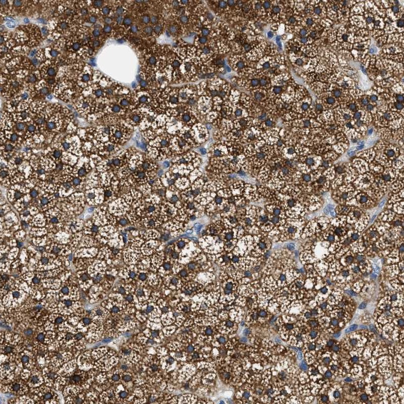 Atlas Antibodies Anti-ALDH3A2 Antibody