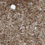 Atlas Antibodies Anti-ALDH3A2 Antibody