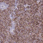 Atlas Antibodies Anti-ALDH1L2 Antibody
