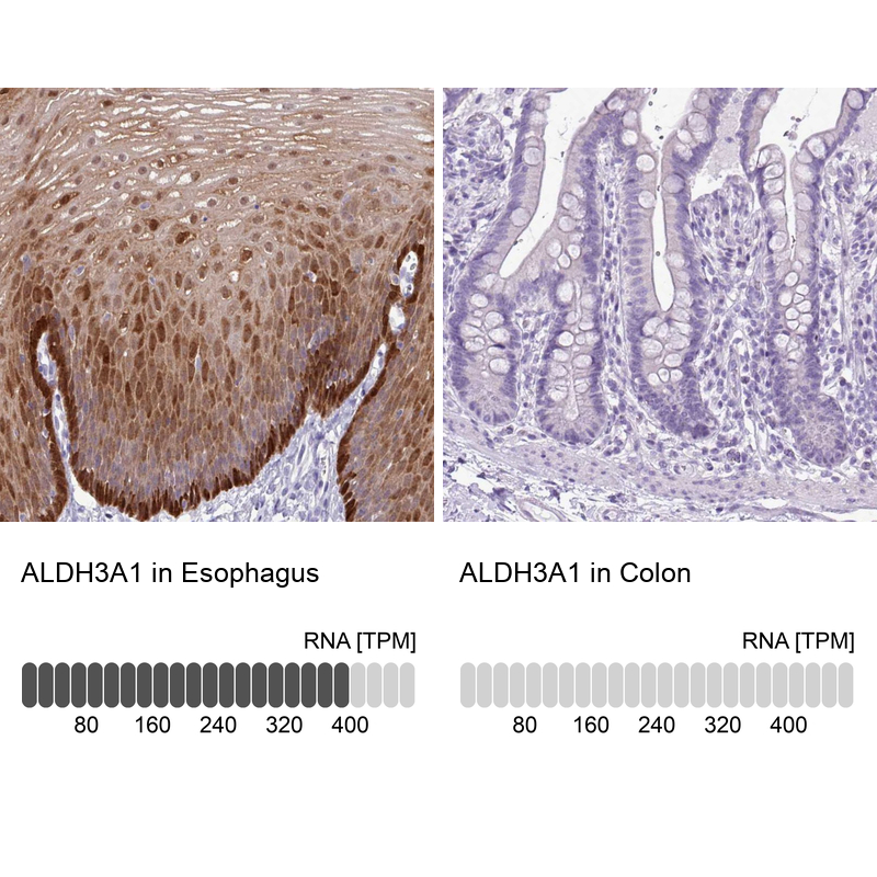 Atlas Antibodies Anti-ALDH3A1 Antibody