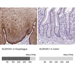 Atlas Antibodies Anti-ALDH3A1 Antibody